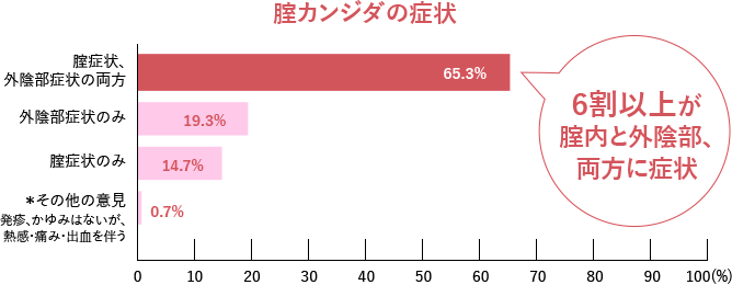 グラフ：腟カンジダの症状 6割以上が腟内と外陰部、両方に症状